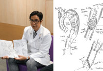 일본인 흉부외과 전문의, 정교한 스케치로 홍콩 환자들과 소통하며 복잡한 대동맥 수술 이해 도와.png