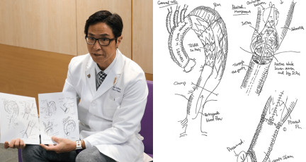 [홍콩뉴스] 일본인 흉부외과 전문의, 정교한 스케치로 홍콩 환자들과 소통하며 복잡한 대동맥 수술 이해 도와…