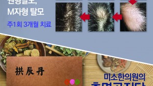 [미소한의원] 탈모치료, 총명공진단