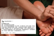 [홍콩뉴스] "발바닥 티눈이 60개?"... 선전 마사지샵 갔다가 100만 원 뜯긴 홍콩 부부