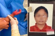 [홍콩사건] 가정부의 잔혹한 아동 학대… 23개월 아기 손에 화상 입히고 껍질 벗겨질 때까지 방치