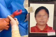 [홍콩사건] 가정부의 잔혹한 아동 학대… 23개월 아기 손에 화상 입히고 껍질 벗겨질 때까지 방치