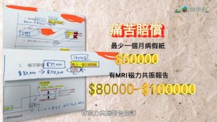 [홍콩뉴스] TVB ‘스쿱’, 변호사·의사 연루된 보험 사기 수법 폭로